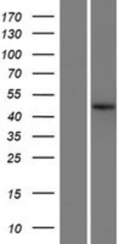 Novus Biologicals&trade;&nbsp;C22orf9 Overexpression Lysate