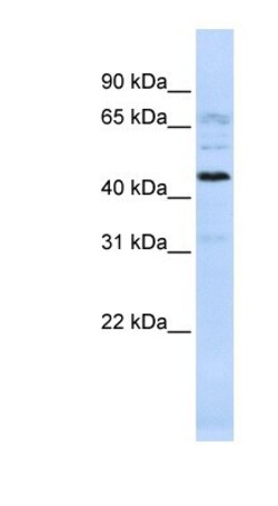 C22orf9 Antibody, Novus Biologicals:Antibodies:Primary Antibodies