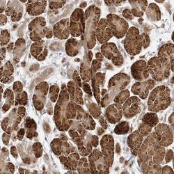 C2CD2 Antibody, Novus Biologicals:Antibodies:Primary Antibodies