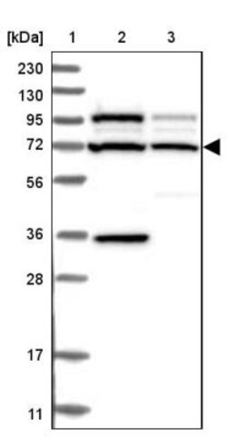 C2CD2 Antibody, Novus Biologicals 0.1mL; Unlabeled:Antibodies, Polyclonal