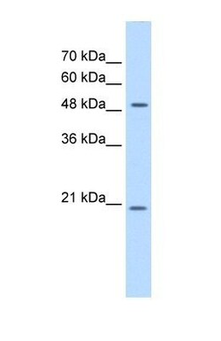 C2GNT3 Antibody, Novus Biologicals 0.05mg; Unlabeled:Antibodies, Polyclonal