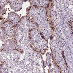 C2orf16 Antibody, Novus Biologicals 25 &mu;L, Unlabeled:Antibodies, Polyclonal