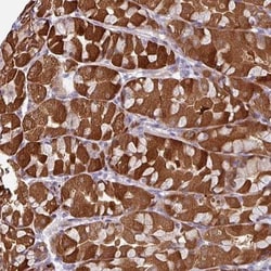 C2orf16 Antibody, Novus Biologicals 25ul | Buy Online | Novus Biologicals | Fisher Scientific