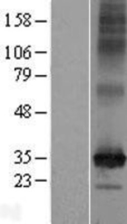 Novus Biologicals™ SLC35F6 Overexpression Lysate