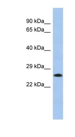 C2orf27B Antibody, Novus Biologicals:Antibodies:Primary Antibodies