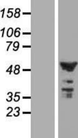 Novus Biologicals&trade;&nbsp;CNOT11 Overexpression Lysate