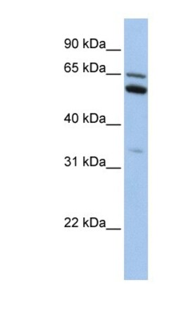 C2orf42 Antibody, Novus Biologicals 100&mu;L; Unlabeled:Antibodies, Polyclonal