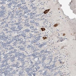 C2orf42 Antibody, Novus Biologicals 0.1mL; Unlabeled:Antibodies, Polyclonal