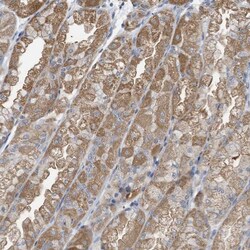 LDAH Antibody, Novus Biologicals:Antibodies:Primary Antibodies
