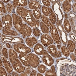 WDCP Antibody, Novus Biologicals:Antibodies:Primary Antibodies