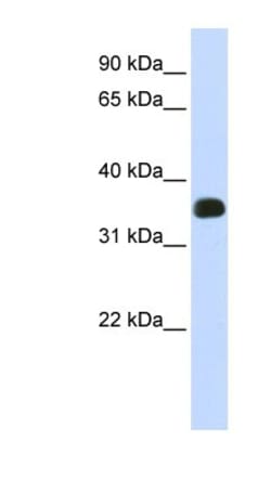 MAIP1 Antibody, Novus Biologicals 0.05mg; Unlabeled:Antibodies, Polyclonal