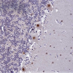 C2orf49 Antibody, Novus Biologicals:Anticuerpos:Anticuerpos primarios
