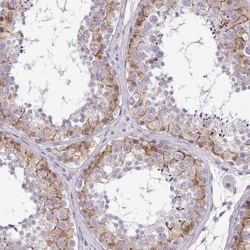 STPG4 Antibody, Novus Biologicals 25 &mu;L, Unlabeled:Antibodies, Polyclonal