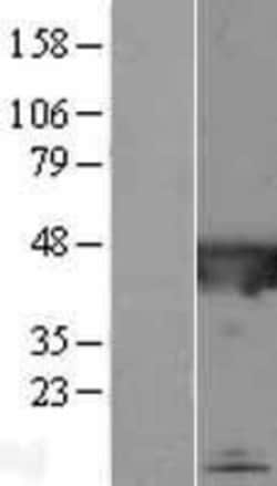 Novus Biologicals&trade;&nbsp;CATIP Overexpression Lysate