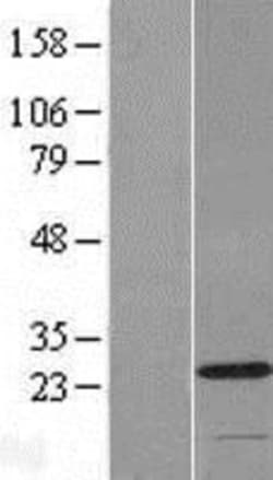 Novus Biologicals&trade;&nbsp;C2orf68 Overexpression Lysate