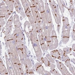 C2orf68 Antibody, Novus Biologicals:Antibodies:Primary Antibodies