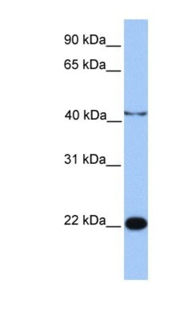 C2orf68 Antibody, Novus Biologicals 100&mu;L; Unlabeled:Antibodies, Polyclonal
