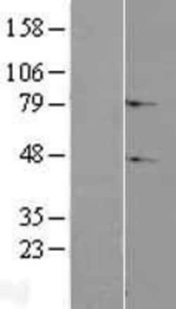 Novus Biologicals&trade;&nbsp;C2orf69 Overexpression Lysate