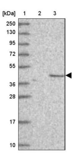 C2orf69 Antibody, Novus Biologicals 0.1mL; Unlabeled:Antibodies, Polyclonal