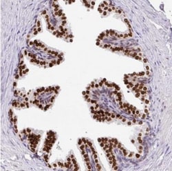 PCARE Antibody, Novus Biologicals 25 &mu;L, Unlabeled:Antibodies, Polyclonal
