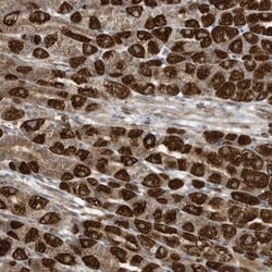 C2orf74 Antibody, Novus Biologicals 0.1mL; Unlabeled:Antibodies, Polyclonal
