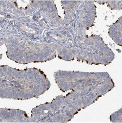 CCDC173 Antibody, Novus Biologicals:Antibodies:Primary Antibodies