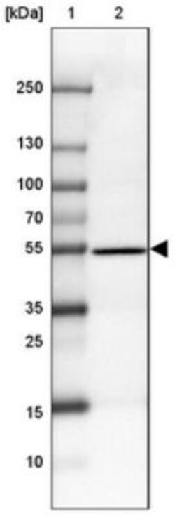 CCDC173 Antibody, Novus Biologicals:Antibodies:Primary Antibodies