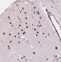 SNORC Antibody, Novus Biologicals 0.1mL; Unlabeled:Antibodies, Polyclonal