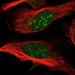 anti-C2orf83, Polyclonal, Novus Biologicals 0.1mL; Unlabeled:Antibodies,