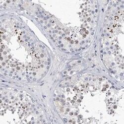 anti-C2orf83, Polyclonal, Novus Biologicals 0.1mL; Unlabeled:Antibodies,