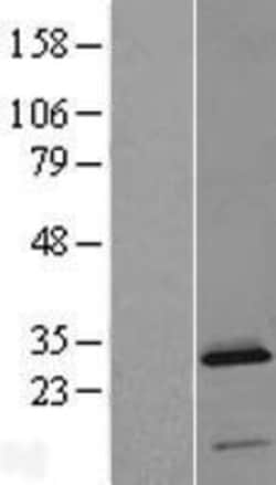 Novus Biologicals™ C2orf88 Overexpression Lysate