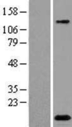 Novus Biologicals&trade;&nbsp;C2orf88 Overexpression Lysate
