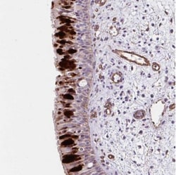 ANKUB1 Antibody, Novus Biologicals 25 &mu;L, Unlabeled:Antibodies, Polyclonal