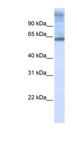 NEPRO Antibody, Novus Biologicals 100&mu;L; Unlabeled:Antibodies, Polyclonal