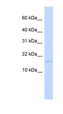 C3orf18 Antibody, Novus Biologicals:Antibodies:Primary Antibodies
