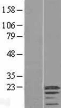Novus Biologicals&trade;&nbsp;C3orf18 Overexpression Lysate
