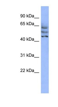 CCDC174 Antibody, Novus Biologicals 100 &mu;L | Buy Online | Novus Biologicals | Fisher Scientific