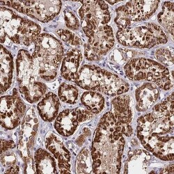 C3orf20 Antibody, Novus Biologicals 25 &mu;L; Unlabeled:Antibodies, Polyclonal