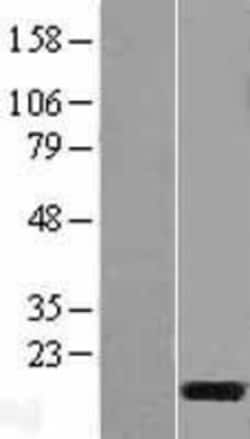 Novus Biologicals&trade;&nbsp;C3orf22 Overexpression Lysate