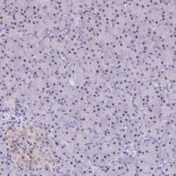 CMSS1 Antibody, Novus Biologicals:Antibodies:Primary Antibodies
