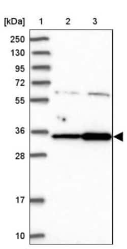 CMSS1 Antibody, Novus Biologicals:Antibodies:Primary Antibodies