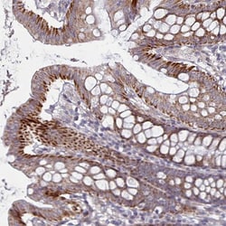 C3orf36 Antibody, Novus Biologicals 25ul | Buy Online | Novus Biologicals | Fisher Scientific