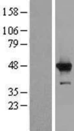 Novus Biologicals&trade;&nbsp;HMCES Overexpression Lysate