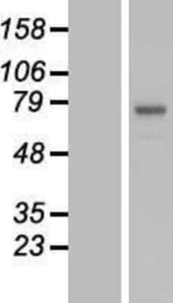 Novus Biologicals&trade;&nbsp;POMGNT2 Overexpression Lysate