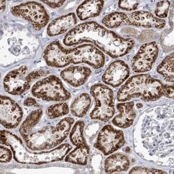 POMGNT2 Antibody, Novus Biologicals 25 &mu;L | Buy Online | Novus Biologicals | Fisher Scientific