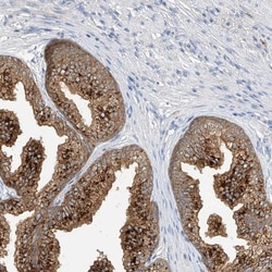 POMGNT2 Antibody, Novus Biologicals:Antibodies:Primary Antibodies