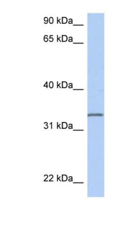 C3orf62 Antibody, Novus Biologicals:Antibodies:Primary Antibodies