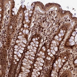 C3orf62 Antibody, Novus Biologicals 25 &mu;L; Unlabeled:Antibodies, Polyclonal