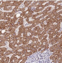 TOPAZ1 Antibody, Novus Biologicals:Antibodies:Primary Antibodies