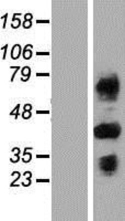 Novus Biologicals™ C4 binding protein B Overexpression Lysate